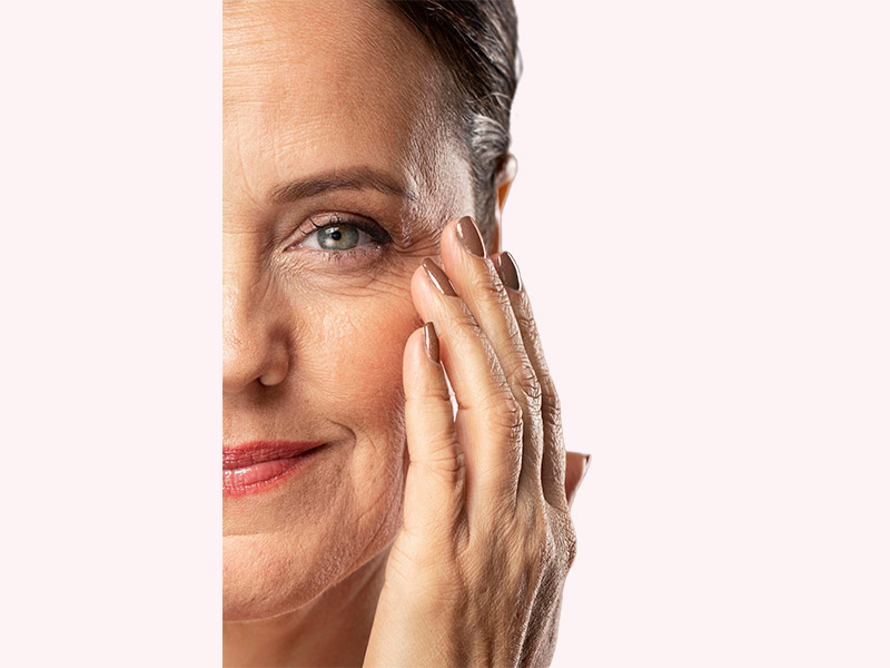 Blefaroplastia