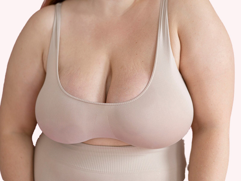 Mamoplastia redutora